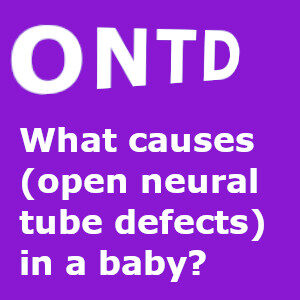 What causes ONTD (open neural tube defects) in a baby?